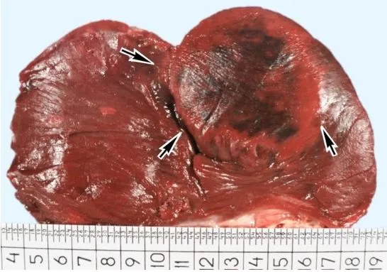 Cardiotons skład - opinie - ile kosztuje - Polska - cena - gdzie kupić.